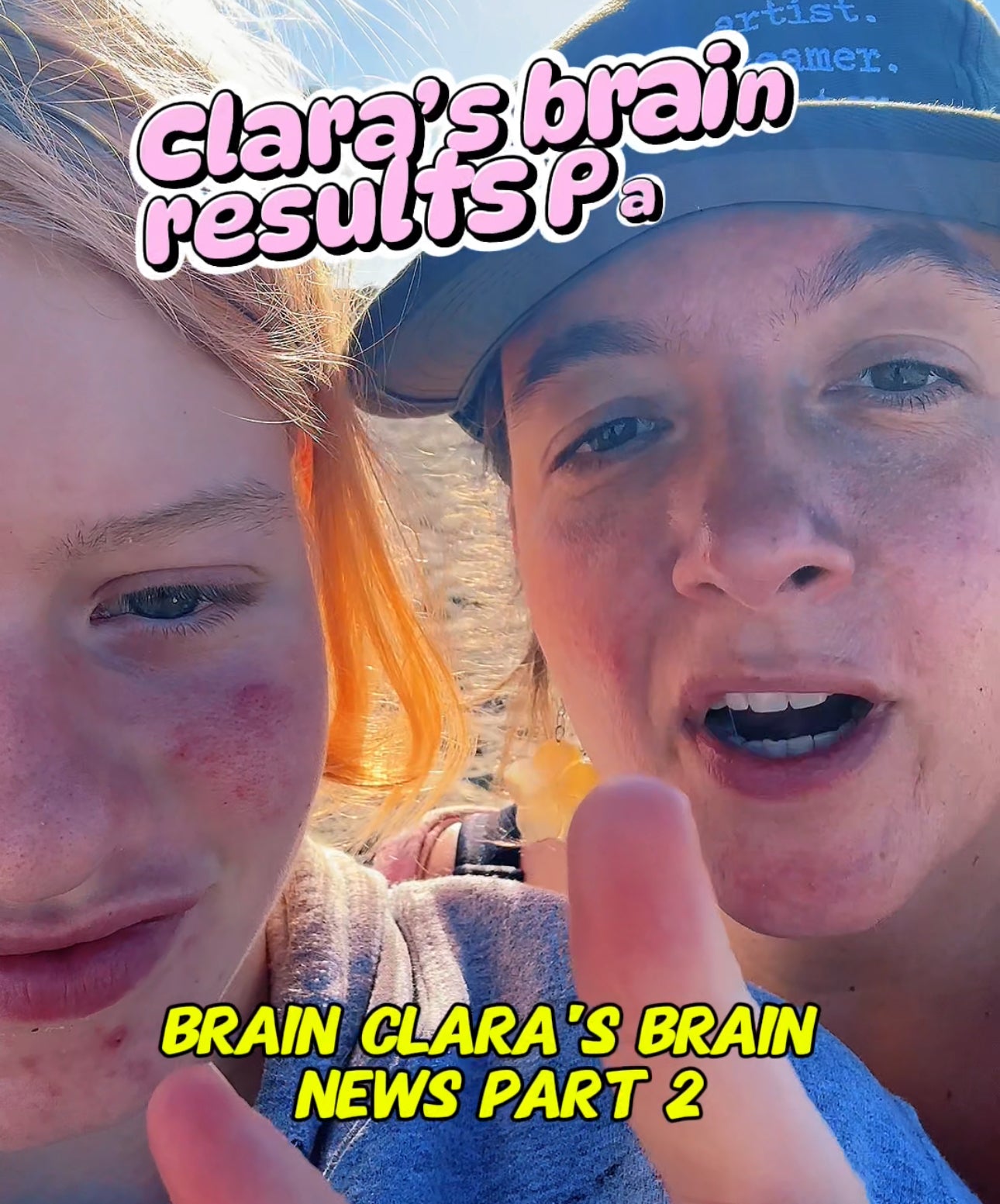 Clara and Doc Amen - Lots of news about Clara's brain!!!